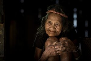 再生医療を用いたしわの集中的ケアとは？